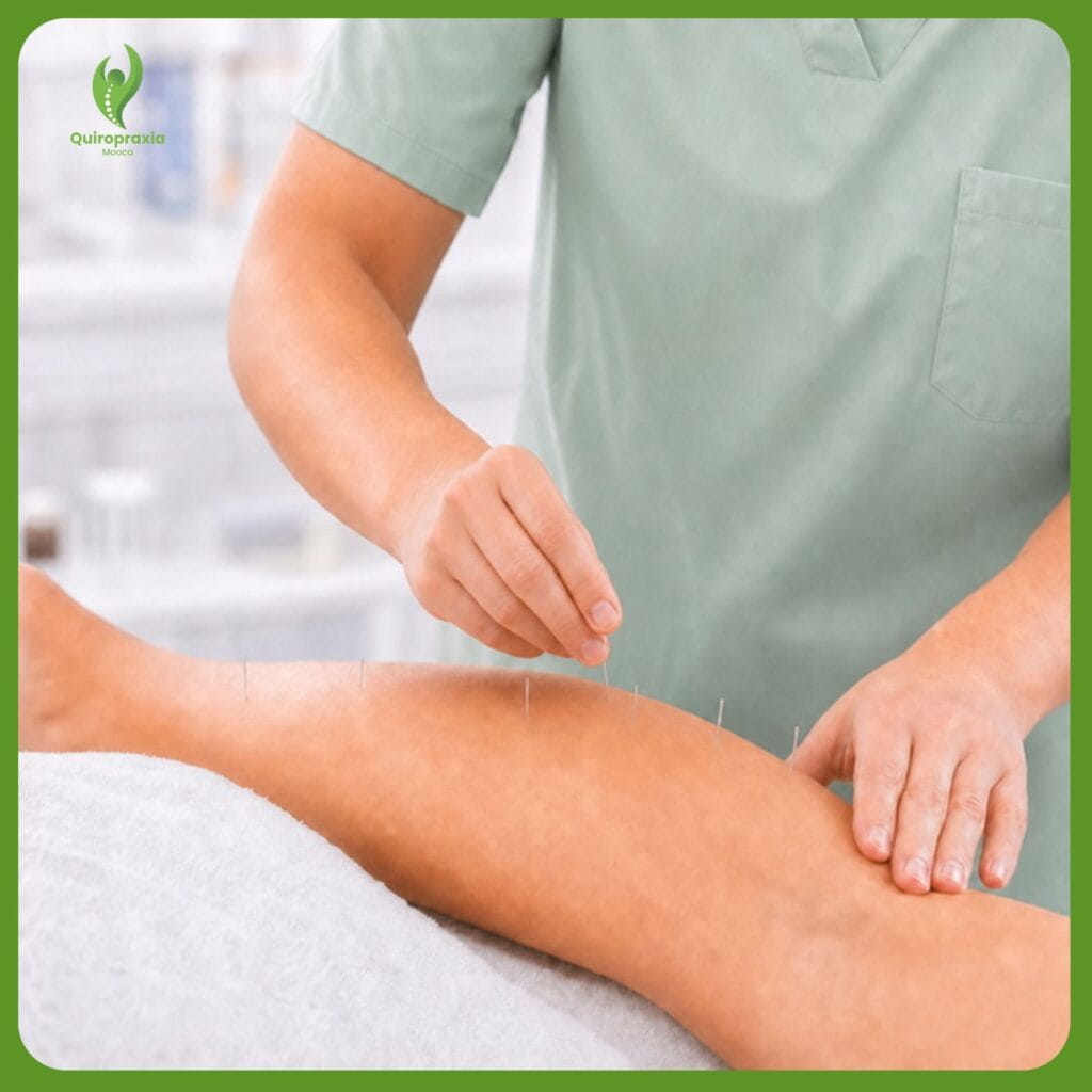 Benefícios da acupuntura — Quiropraxia Mooca